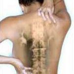 Phương pháp mới điều trị chứng đau nhức thần kinh