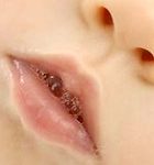 Nước bọt giải độc và giảm đau
