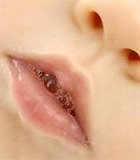 Nước bọt của sên làm hết cơn đau