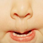 Nhìn dịch mũi đoán bệnh