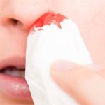 Nước mũi có máu, nguyên nhân do đâu?