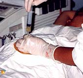 Phát hiện dị tật thai nhi qua chẩn đoán tiền sinh