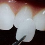 Nuôi răng thật từ tế bào