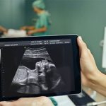 Phẫu thuật nứt đốt sống cho thai nhi trong bụng mẹ