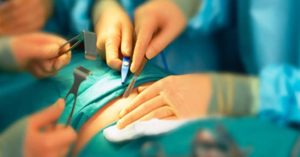 Phẫu thuật thắt dạ dày giúp điều trị bệnh tiểu đường tuýp 2