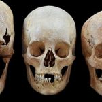 Vì sao phụ nữ Trung cổ có hộp sọ giống người ngoài hành tinh?
