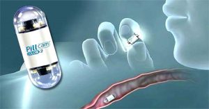“Con nhộng” PillCam của người Do Thái: Camera nội soi ruột “tí hon”, chi phí rẻ hơn nội soi thường