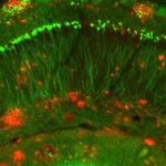 Phát hiện loại protein có thể đảo ngược triệu chứng Alzheimer