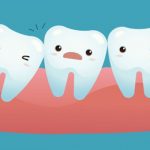 Vì sao hay mọc ngu lung tung mà chúng vẫn có tên là răng khôn?