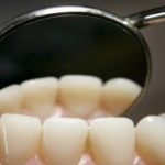 Sự liên quan của vi khuẩn răng miệng và các bệnh ung thư