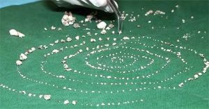 Tại sao bé 7 tuổi có đến 526 chiếc răng?