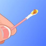 Ráy tai như thế nào là bình thường?