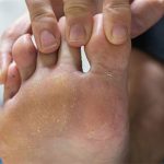 Phát minh mới: Phủ nano trên vớ để trị hôi chân