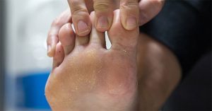 Phát minh mới: Phủ nano trên vớ để trị hôi chân