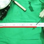Phát hiện sâu ký sinh trong não người