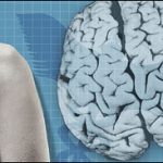 Tay chân ngắn liên quan đến nguy cơ bị mất trí