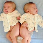 Ai Cập: phẫu thuật thành công cặp song sinh dính liền đầu tiên
