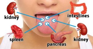 6 sự thay đổi của lưỡi có thể tiết lộ rất nhiều về sức khoẻ