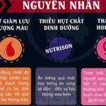 Giải cứu cho đôi tay luôn lạnh ngắt vào mùa đông