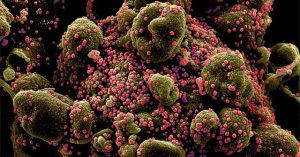 Phát hiện virus mới giống SARS-CoV-2 ở Trung Quốc