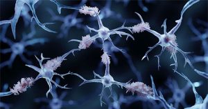 Truyền máu sẽ mở ra một hy vọng mới trong việc điều trị bệnh Alzheimer