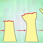 Liệu pháp tế bào gốc kết hợp sóng âm có thể giúp xương gãy mọc trở lại