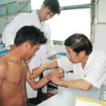 Chữa liệt tay bằng dây thần kinh lấy từ chân