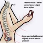 Thiết bị giúp phụ nữ “lên đỉnh” bằng nút bấm