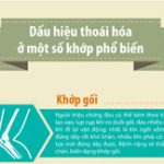 Dấu hiệu nhận biết sớm triệu chứng thoái hóa khớp