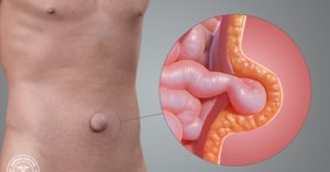 Đừng bao giờ để bụng của bạn gặp phải tình trạng này
