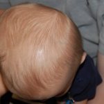 Thóp đầu của trẻ sơ sinh: những điều mẹ nên biết!