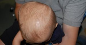 Thóp đầu của trẻ sơ sinh: những điều mẹ nên biết!