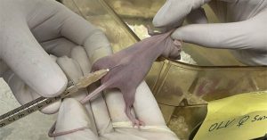 Các nhà khoa học tìm ra cách diệt khối u buồng trứng bằng virus sởi