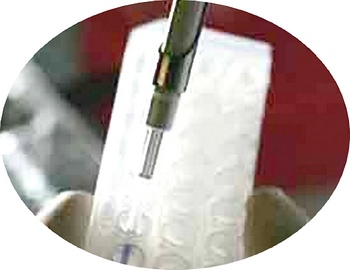 Dụng cụ mới chuẩn đoán ung thư tuyến tiền liệt