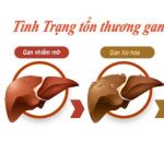 7 tác hại do lạm dụng kháng sinh