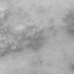 Điểm danh các loại ung thư do virus HPV