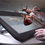 Trái tim 3D giúp bác sĩ phẫu thuật thử trên bệnh thật