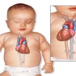 Những người có trái tim bên phải