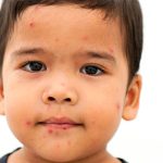 Dịch cúm bí ẩn bùng phát tại Ấn Độ