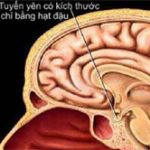 Các căn bệnh “triệu người mắc một” giống Wanbi Tuấn Anh trên thế giới