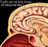 Các căn bệnh “triệu người mắc một” giống Wanbi Tuấn Anh trên thế giới