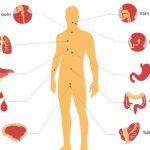 Tỷ lệ đàn ông Việt Nam chết vì ung thư thuộc loại cao nhất thế giới