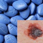 Cảnh báo nguy cơ ung thư da vì dùng Viagra