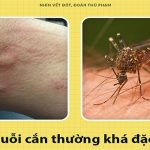 Đọc luôn để nắm được cách “soi” vết cắn, biết ngay con gì đốt
