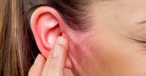 Bệnh viêm tai ngoài là gì?