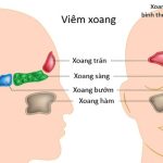 Viêm xoang ở trẻ em: Nguyên nhân, triệu chứng và cách điều trị