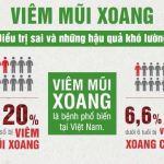 80% bệnh nhân viêm xoang đang điều trị sai cách