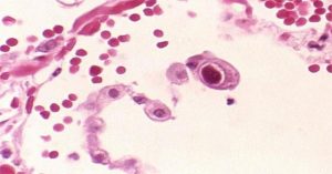 Tìm ra loại virus có thể giúp tăng cường miễn dịch cho người cao tuổi