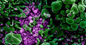 Ảnh chụp virus nCoV “giết chết” tế bào người