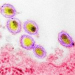 Lời cảnh báo cho đại dịch Covid-19 nhìn từ chủng HIV mới